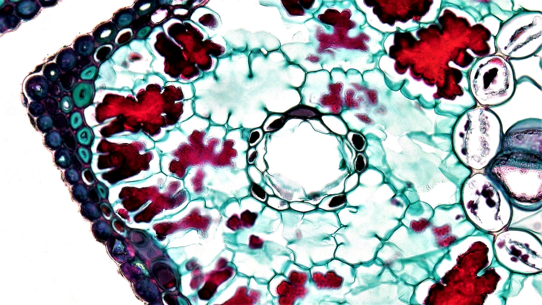 cell seen under microscope