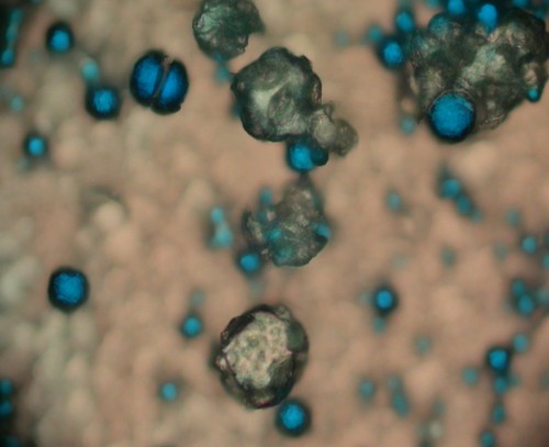 Cancer Targeted Treatments from Space Station Discoveries (NASA, International Space Station, 02/26/14)