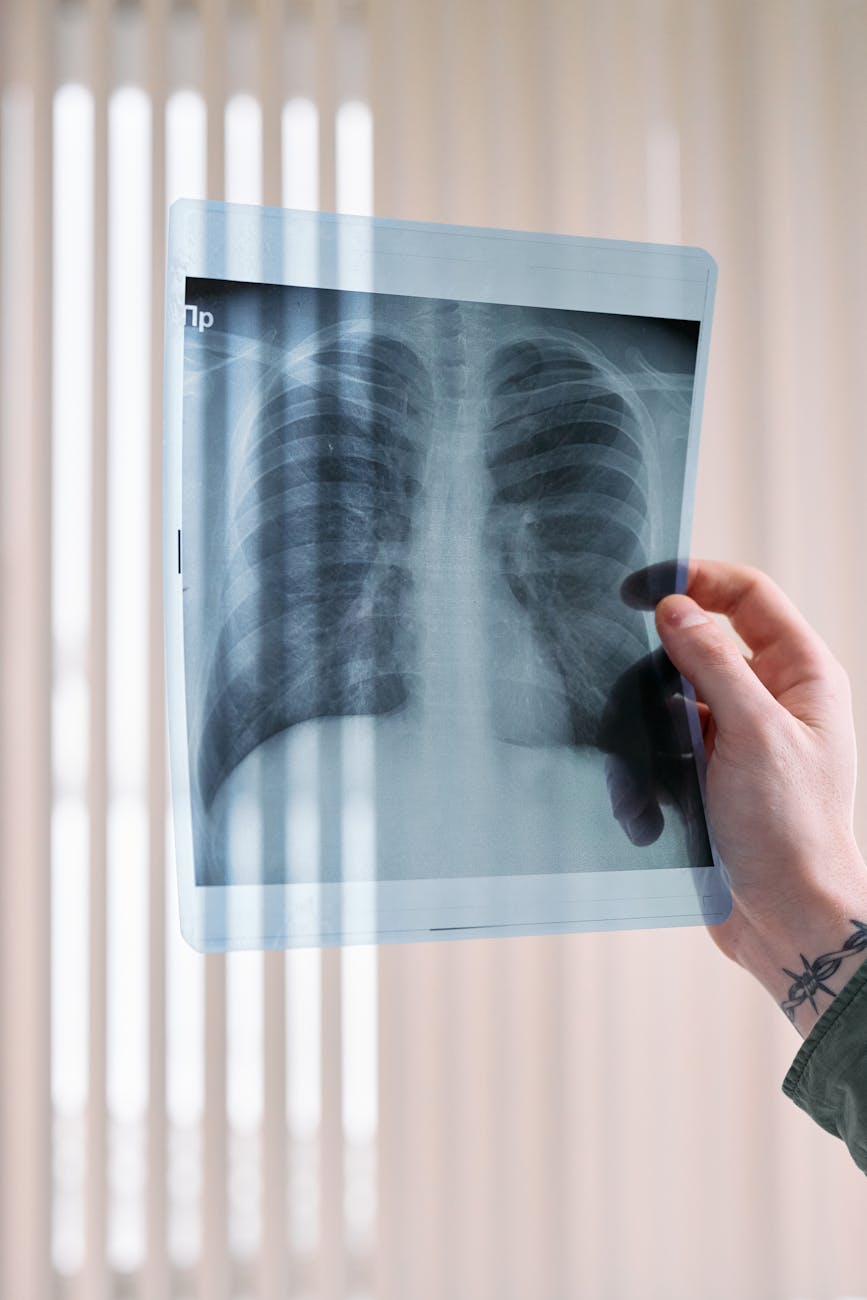 doctor looking at lung x ray