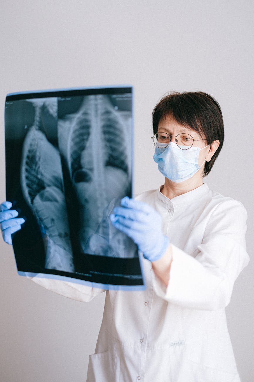 photo of doctor holding x ray result